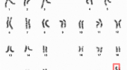 X Chromosomes (per Wikipedia)